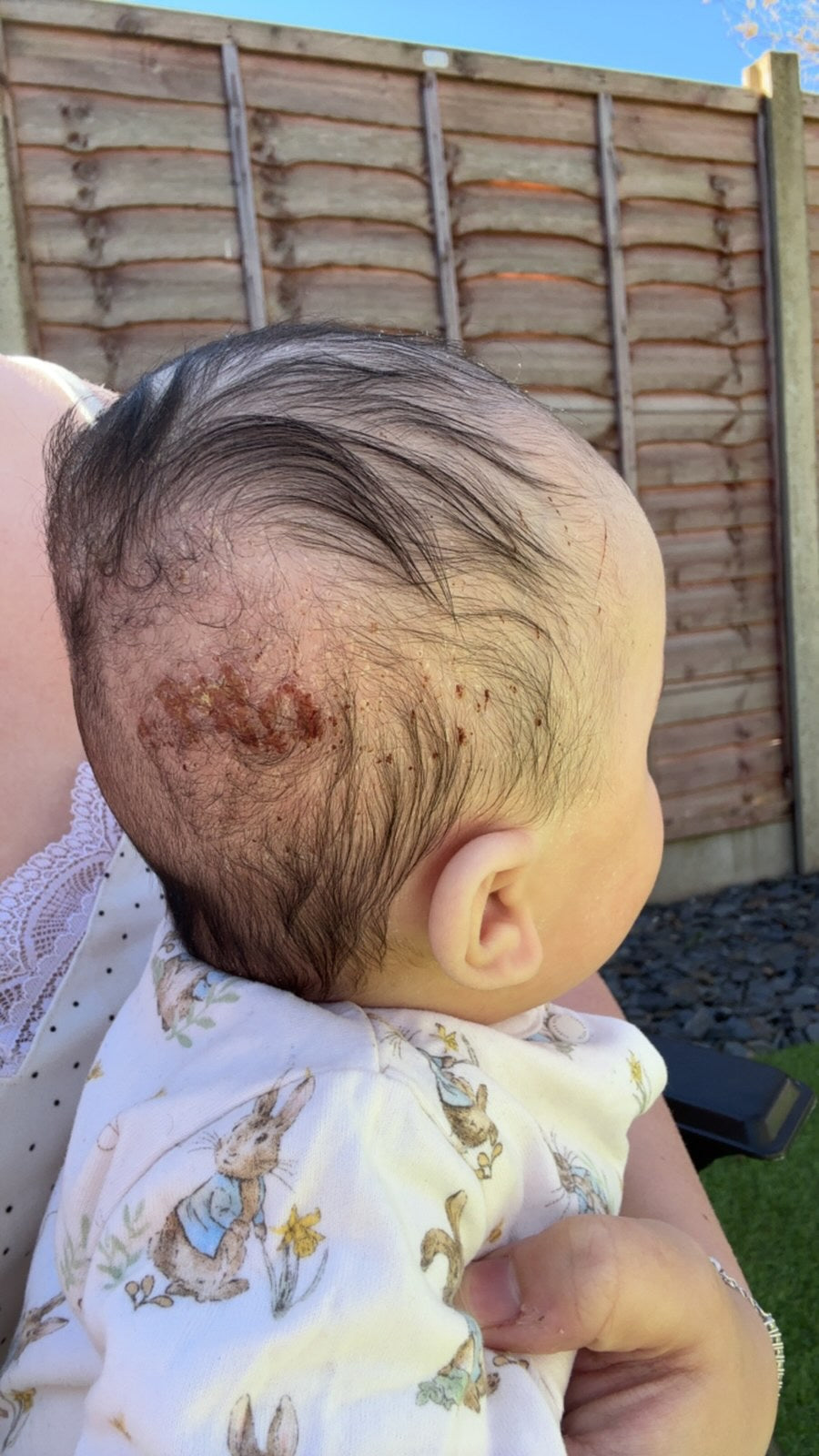 Baby Regen Elixir Oil™ | Scalp Recovery + Growth Support Oil