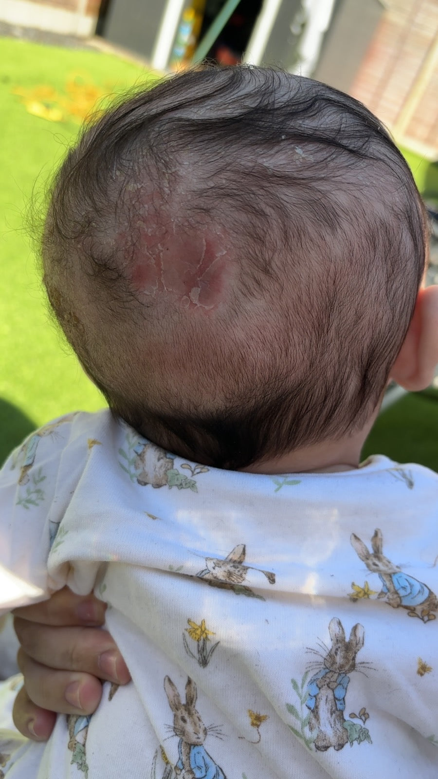 Baby Regen Elixir Oil™ | Scalp Recovery + Growth Support Oil