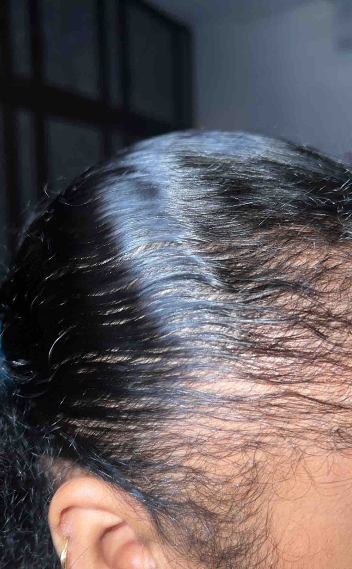 Regrowth & Scalp Recovery Plan – High Priestess Crown Hair Recovery Programme (£250)