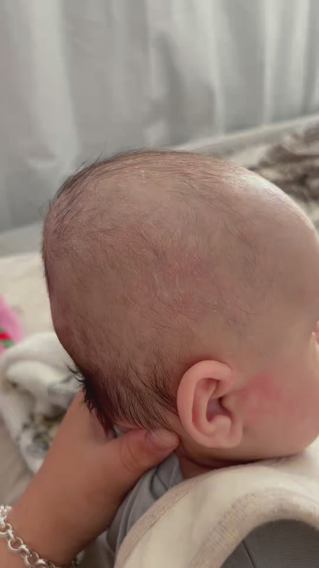 Baby Regen Elixir Oil™ | Scalp Recovery + Growth Support Oil